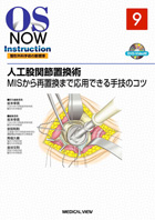 人工股関節置換術  OS NOW Instruction No.9