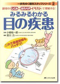 みるみるわかる目の疾患