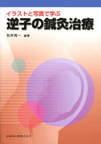 イラストと写真で学ぶ 逆子の鍼灸治療