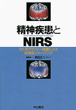 精神疾患とNIRS 光トポグラフィー検査による脳機能イメージング